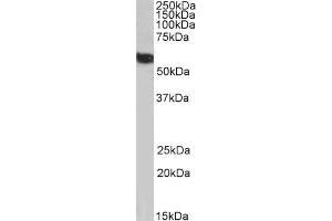 Biotinylated ABIN5539616 (1µg/ml) staining of Human Liver lysate (35µg protein in RIPA buffer), exactly mirroring its parental non-biotinylated product. (FTCD 抗体  (N-Term) (Biotin))