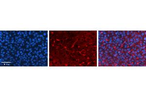 Rabbit Anti-GNS Antibody   Formalin Fixed Paraffin Embedded Tissue: Human Liver Tissue Observed Staining: Cytoplasm in Kupffer cells in sinusoids Primary Antibody Concentration: 1:100 Other Working Concentrations: N/A Secondary Antibody: Donkey anti-Rabbit-Cy3 Secondary Antibody Concentration: 1:200 Magnification: 20X Exposure Time: 0. (GNS 抗体  (C-Term))