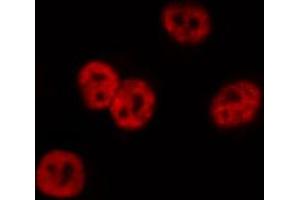 ABIN6267014 staining Hela by IF/ICC. (CTBP1 抗体  (pSer422))