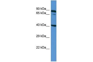 Host: Rabbit Target Name: ZDHHC11B Sample Type: NCI-H226 Whole cell lysates Antibody Dilution: 1. (ZDHHC11B 抗体  (N-Term))