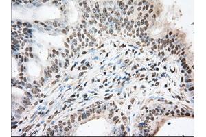 Immunohistochemical staining of paraffin-embedded Human prostate tissue using anti-BAT1 mouse monoclonal antibody. (BAT1 抗体)