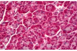 Anti-PTPN22 antibody IHC staining of human pancreas. (PTPN22 抗体)