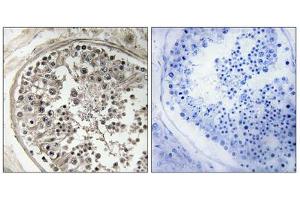 Immunohistochemistry analysis of paraffin-embedded human testis tissue using MRPS5 antibody. (MRPS5 抗体  (C-Term))