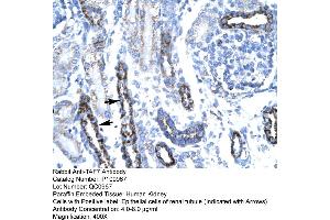 Immunohistochemistry (IHC) image for anti-TAF7 RNA Polymerase II, TATA Box Binding Protein (TBP)-Associated Factor, 55kDa (TAF7) (N-Term) antibody (ABIN2774669)