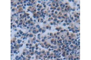 IHC-P analysis of Rat Tissue, with DAB staining. (CXCL9 抗体  (AA 22-125))
