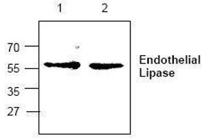Image no. 1 for anti-Lipase, Endothelial (LIPG) antibody (ABIN127288) (LIPG 抗体)