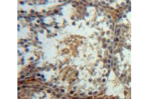 Used in DAB staining on fromalin fixed paraffin-embedded Testis tissue (WFDC2 抗体  (AA 30-124))