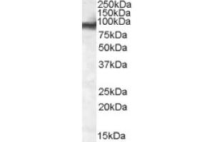 Image no. 1 for anti-Ewing Sarcoma Breakpoint Region 1 (EWSR1) (Internal Region) antibody (ABIN375098) (EWSR1 抗体  (Internal Region))