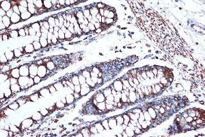 Immunohistochemistry of paraffin-embedded human colon using HSPE1/HSP10/HSPE1/HSP10/CPN10 Rabbit mAb (ABIN7267567) at dilution of 1:100 (40x lens). (HSPE1 抗体)