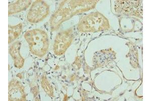 Immunohistochemistry of paraffin-embedded human kidney tissue using ABIN7156394 at dilution of 1:100 (INTS1 抗体  (AA 451-710))