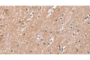 Immunohistochemistry of paraffin-embedded Human brain using RAB8A Polyclonal Antibody at dilution of 1:45 (RAB8A 抗体)