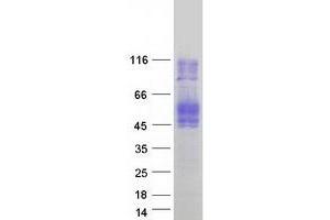 Western Blotting (WB) image for CD84 (CD84) (Transcript Variant 3) protein (Myc-DYKDDDDK Tag) (ABIN2713794)