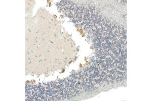 Immunohistochemistry of paraffin-embedded mouse brain using CNTN4 Rabbit mAb (ABIN7266495) at dilution of 1:100 (40x lens).