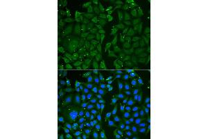Immunofluorescence (IF) image for anti-Transketolase (TKT) antibody (ABIN1980330) (TKT 抗体)