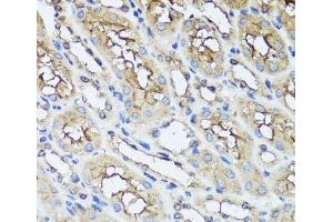 Immunohistochemistry of paraffin-embedded Mouse kidney using AIP Polyclonal Antibody at dilution of 1:100 (40x lens). (AIP 抗体)