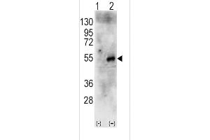 Western blot analysis of RPS6KB2 (arrow) using rabbit polyclonal RPS6KB2 Antibody (Center) (R). (RPS6KB2 抗体  (AA 243-272))