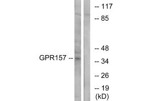 Western blot analysis of extracts from NIH-3T3 cells, using GPR157 antibody. (GPR157 抗体  (Internal Region))