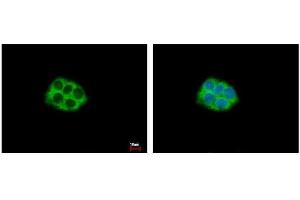 Immunofluorescence (IF) image for anti-Ribosomal Protein L5 (RPL5) antibody (ABIN2855187)