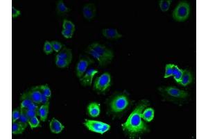 Immunofluorescent analysis of MCF-7 cells using ABIN7164481 at dilution of 1:100 and Alexa Fluor 488-congugated AffiniPure Goat Anti-Rabbit IgG(H+L) (GPR21 抗体  (AA 305-349))