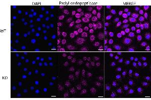 Immunocytochemical staining of HeLa cells using Prolyl endopeptidase like antibody (ABIN7799923), 1:1,000), Top panel: wild-type (WT), Bottom panal: Prolyl endopeptidase like shRNA knockdown (KD). (Recombinant PREPL 抗体)