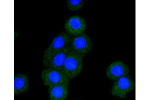 Immunofluorescence analysis of CRC cells using BAK1 antibody (ABIN5996915). (BAK1 抗体)