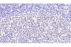 Detection of IL6 in Human Lymph node Tissue using Polyclonal Antibody to Interleukin 6 (IL6) (IL-6 抗体  (AA 29-212))