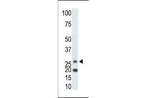 The anti-KHK Pab (ABIN391089 and ABIN2841230) is used in Western blot to detect KHK in mouse kidney tissue lysate. (Ketohexokinase 抗体  (C-Term))