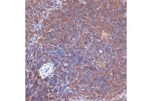 Immunohistochemistry of paraffin-embedded rat spleen using PI3 Kinase p110 delta Rabbit mAb (ABIN7269326) at dilution of 1:100 (40x lens). (PIK3CD 抗体)