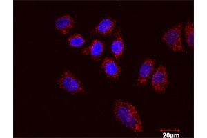 Confocal microscopy image of Proximity Ligation Assay of protein-protein interactions between ACTN4 and CTNNB1.