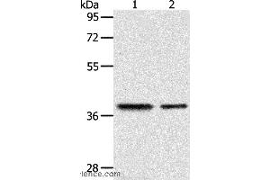 Western blot analysis of Human fetal kidney and fetal muscle tissue, using CNN3 Polyclonal Antibody at dilution of 1:400 (CNN3 抗体)