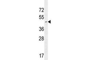 CD34 antibody western blot analysis in Jurkat lysate.