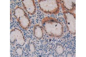 IHC-P analysis of stomach tissue, with DAB staining. (Fibrillin 3 抗体  (AA 403-667))
