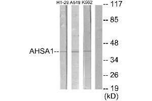 Western blot analysis of extracts from HT29 cells, A549 cells and K562 cells, using Collagen IX α2 antibody. (Collagen Type IX alpha 2 (COL9A2) (Internal Region) 抗体)