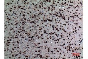 Immunohistochemistry (IHC) analysis of paraffin-embedded Mouse Brain, antibody was diluted at 1:100.