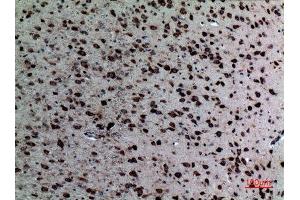 Immunohistochemistry (IHC) analysis of paraffin-embedded Mouse Brain, antibody was diluted at 1:100. (NR1H3 抗体  (Internal Region))