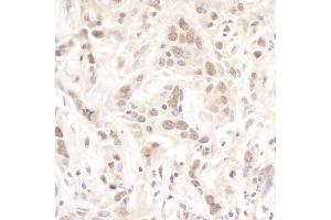 Immunohistochemistry (IHC) image for anti-Polymerase (DNA Directed), lambda (POLL) (AA 525-575) antibody (ABIN7454415) (POLL 抗体  (AA 525-575))