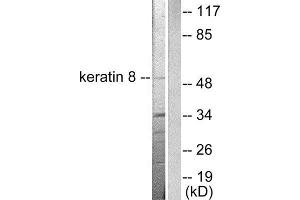 Western Blotting (WB) image for anti-Keratin 8 (KRT8) (C-Term) antibody (ABIN1848642) (KRT8 抗体  (C-Term))