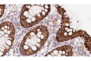 ABIN6279860 at 1/100 staining Mouse colon tissue by IHC-P.