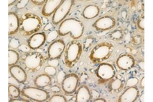 ABIN7094163 and ABIN7098207 at 1/100 staining human normal kidney tissue by IHC-P. (DDX6 抗体  (C-Term))