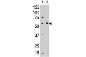 The SIGLEC8 polyclonal antibody  is used in Western blot to detect SIGLEC8 in mouse liver tissue lysate (lnae 1) and in HL-60 cell lysate (lane 2) . (SIGLEC8 抗体  (C-Term))