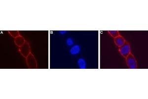 Immunocytochemistry (ICC) image for anti-Potassium Intermediate/small Conductance Calcium-Activated Channel, Subfamily N, Member 4 (KCNN4) (Extracellular) antibody (Biotin) (ABIN7043464)