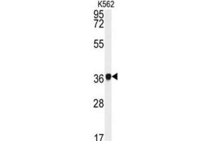 Western Blotting (WB) image for anti-Neutrophil Cytosolic Factor 4, 40kDa (NCF4) antibody (ABIN3003340)