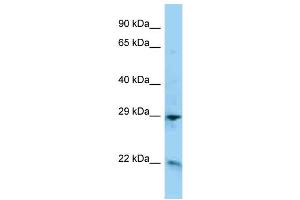 WB Suggested Anti-ADM Antibody Titration: 1. (Adrenomedullin 抗体  (C-Term))