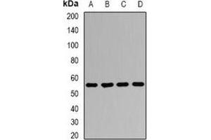 Western blot analysis of AGFG1 expression in Jurkat (A), HepG2 (B), mouse lung (C), mouse testis (D) whole cell lysates. (AGFG1 抗体)