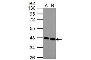 WB Image Sample (30 ug of whole cell lysate) A: NIH-3T3 B: JC 10% SDS PAGE antibody diluted at 1:1000 (CNN3 抗体)