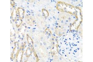 Immunohistochemistry of paraffin-embedded Rat kidney using BSND Polyclonal Antibody at dilution of 1:100 (40x lens). (BSND 抗体)