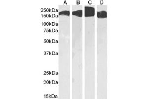 Western Blot using anti-CD171 antibody L1-14. (Recombinant L1CAM 抗体)