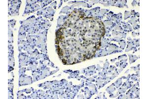 Immunohistochemistry (IHC) image for anti-Coatomer Protein Complex, Subunit epsilon (COPE) (AA 80-308) antibody (ABIN5518902)
