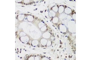 Immunohistochemistry (Paraffin-embedded Sections) (IHC (p)) image for anti-Chromobox Homolog 3 (CBX3) (AA 1-183) antibody (ABIN1512681)