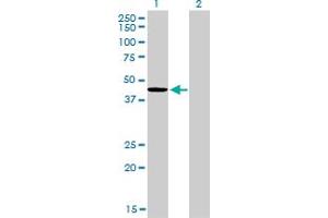 Western Blot analysis of TXNDC4 expression in transfected 293T cell line by TXNDC4 monoclonal antibody (M01A), clone 3C7. (ERP44 抗体  (AA 30-406))